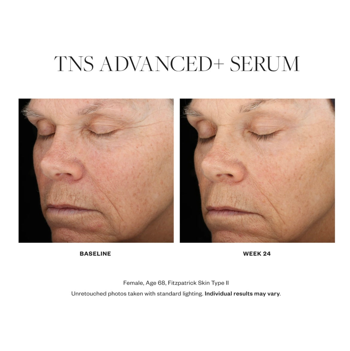 Skin Medica TNS Advanced+ Serum