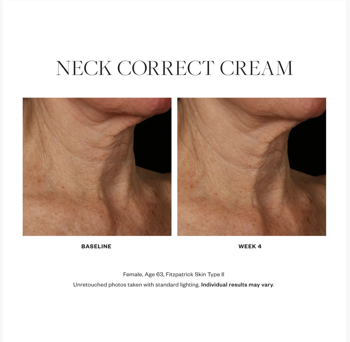 Skin Medica Neck Correct Cream