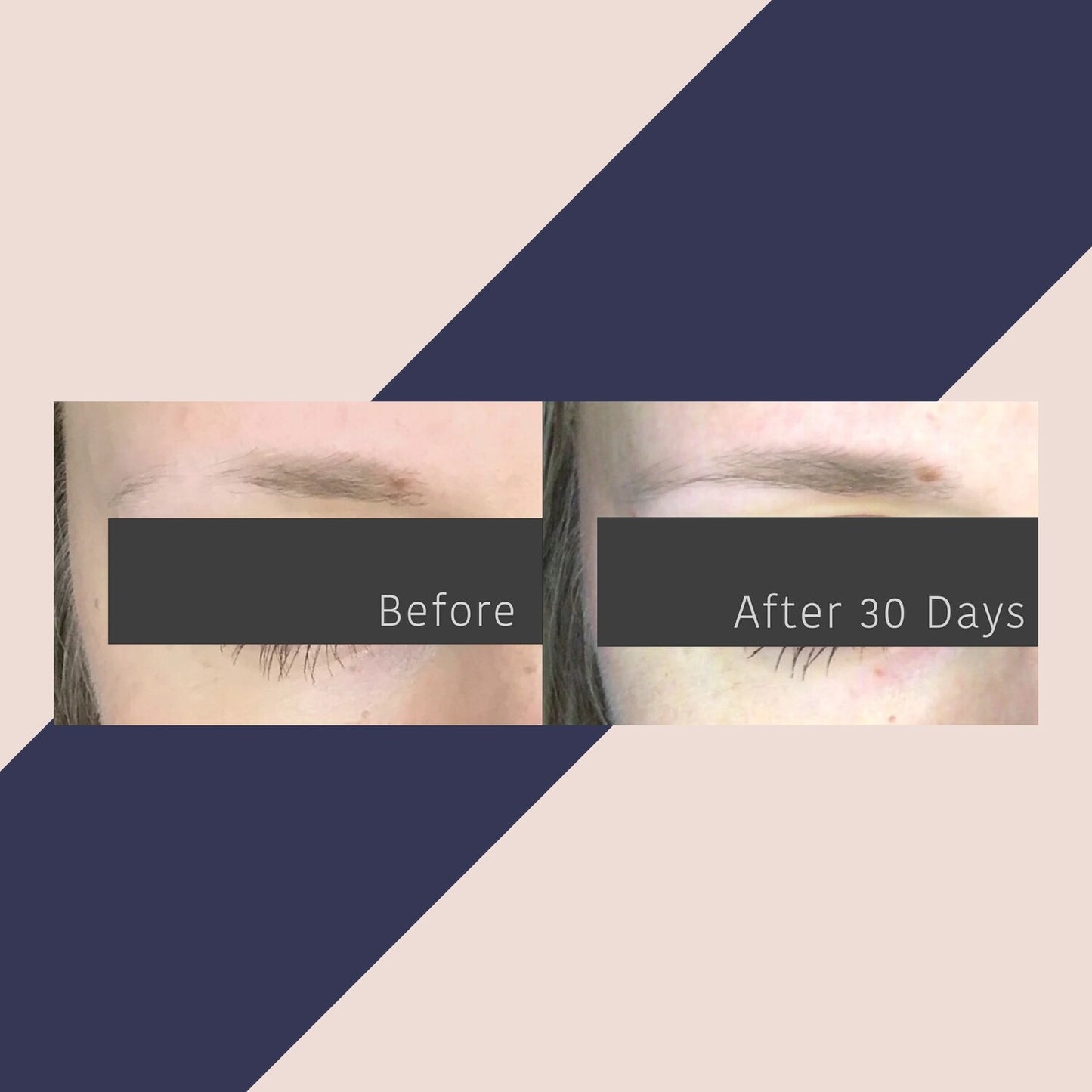 AnteAGE Overnight Brow Serum